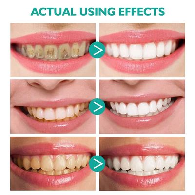 Travel Friendly Foam Toothpaste 2PCS Baking Soda Spearmint Flavor Mousse Whitening Toothpaste