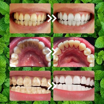2PCS Purple Teeth Restoration Mineral Powder Strengthening Teeth And Gums Health