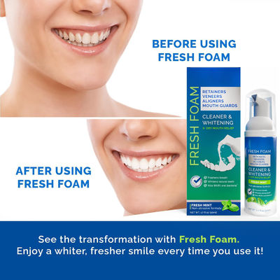 50ml Aligner Cleaner Whitening Foam for Mouth Guard Veneer Fights Bad Breath
