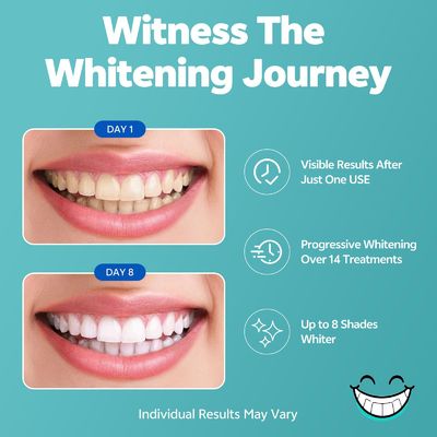 Coconut Tooth Whitening Strips Reduced Sensitivity Formula 28 Strips 14 Full Treatments