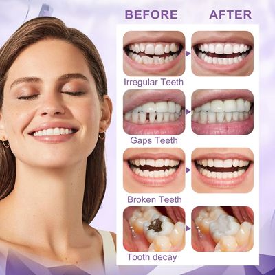 100 Grams Tooth Repair Kit Moldable Beads For Teeth Repair DIY Natural Filling Fake Teeth