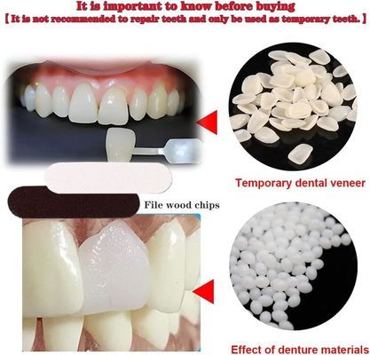 temporary solution Tooth Repair Kit Thermal Fitting Beads Granules And Fake Teeth