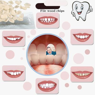 temporary solution Tooth Repair Kit Thermal Fitting Beads Granules And Fake Teeth