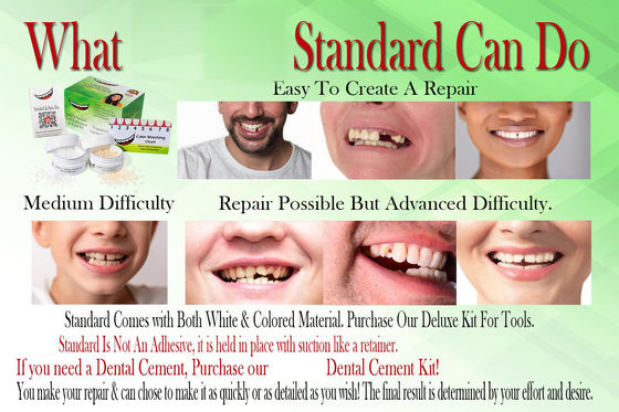 Daily Use Standard Dental Repair Kit For Fix Gaps Broken Tooth Fast And Easy 