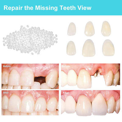 OEM Moldable Fake Teeth Tooth Repair Kit , Quick Fix Broken Tooth Repair Kit